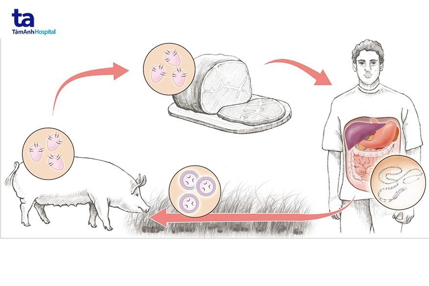 Sơ đồ vòng đời sán dải heo Taenia solium, nguyên nhân gây bệnh lợn gạo