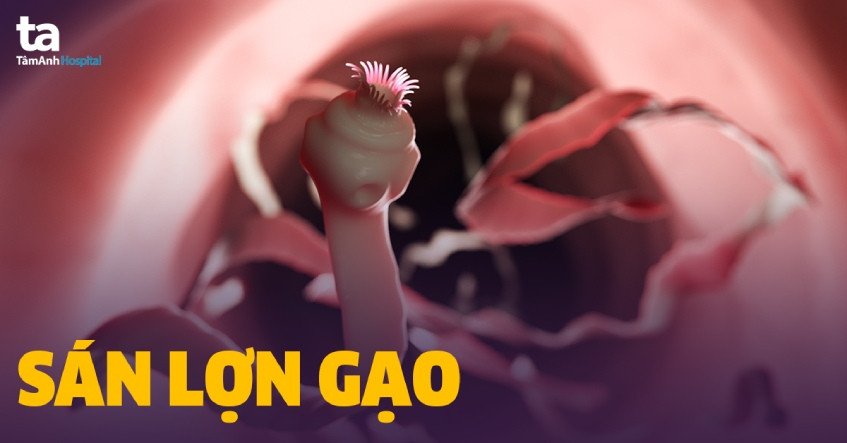 Thịt lợn có chứa ấu trùng sán dải heo gây bệnh lợn gạo