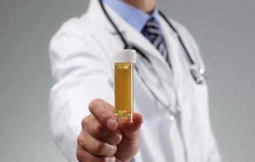 Nước tiểu bị đục có thể hiểu là nước tiểu trông giống như nước vo gạo